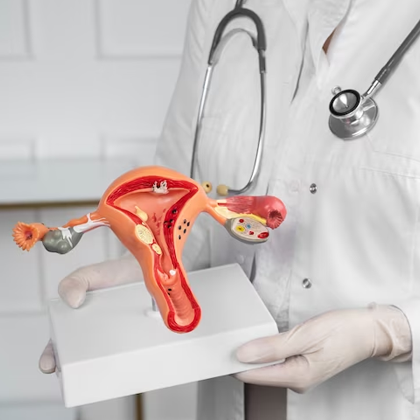 Uterus Removal Overview