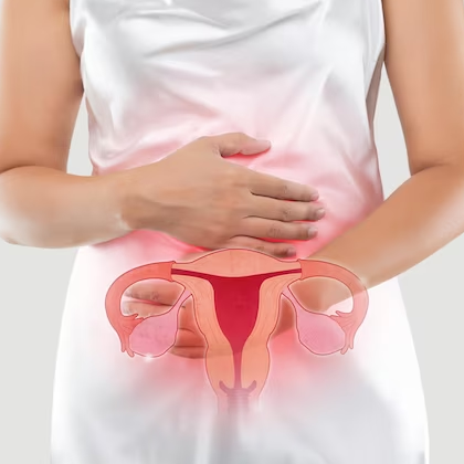 Uterine Fibroids overview